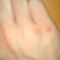 The Callouses on Your Hands by Skitz Ø The Callouses on Your Hands by Skitz Ø