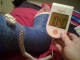 Bone Stimulation