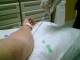 PICC removal 2