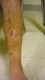 Left Leg
