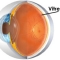 Vitreous.jpg
