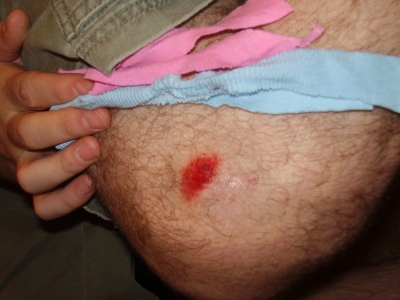 simon knee.jpg