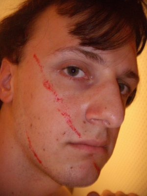 Scarred Scarred
