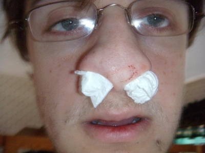 Plugging my nose