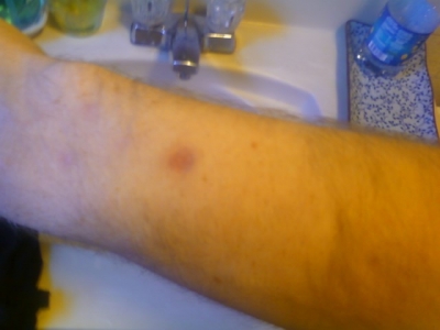 my right arm