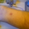 The Callouses on Your Hands by waffles!!! The Callouses on Your Hands by waffles!!!