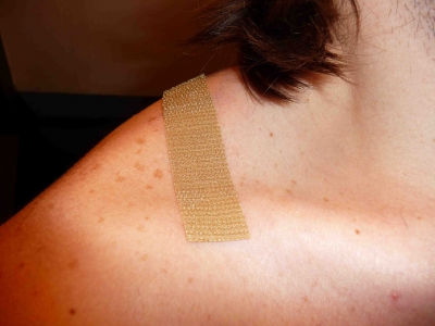 Velcro and skin