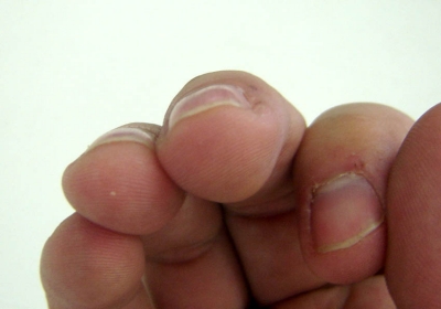 Right middle finger