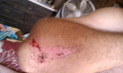 elbow.jpg