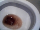 Vomit