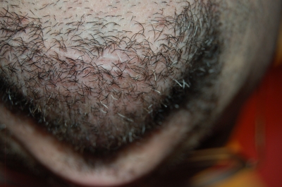 A chin, a scar, a story