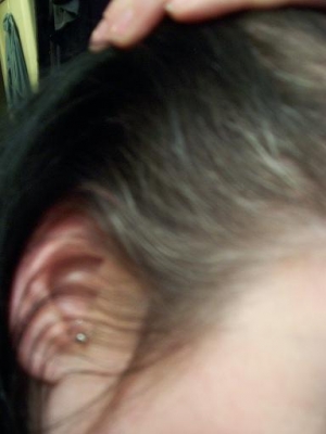 right side right side