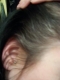 right side