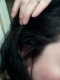 right side
