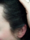 left side